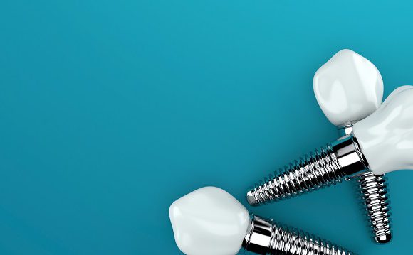 How to Care for Dental Implants