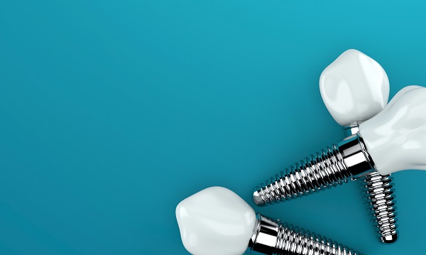 How to Care for Dental Implants